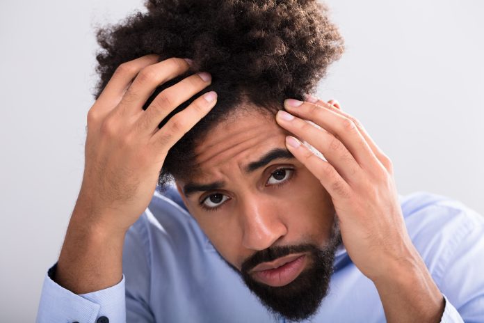 Treating Hair Loss Treating Hair Loss