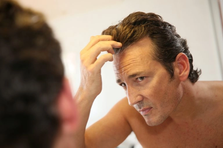 hur man gör Minoxidil lösning för håravfall behandling