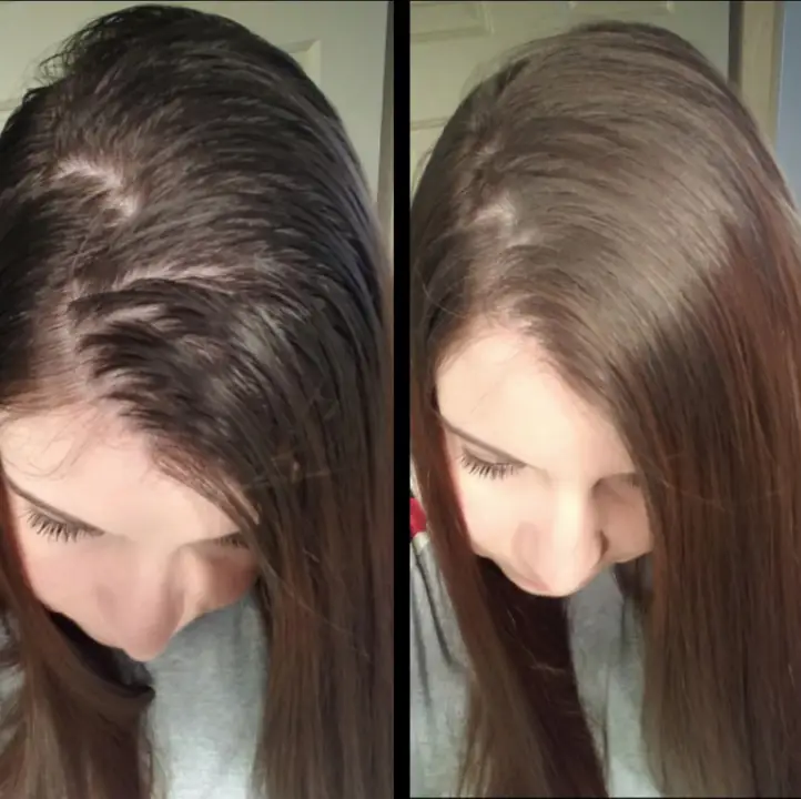 How To Get Rid Of Greasy Hair Without Dry Shampoo