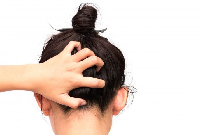 Home Remedies for Dandruff and Oily Hair Home Remedies for Dandruff and Oily Hair