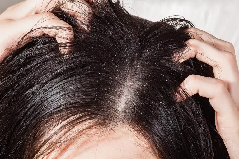 How to Make Topical Finasteride