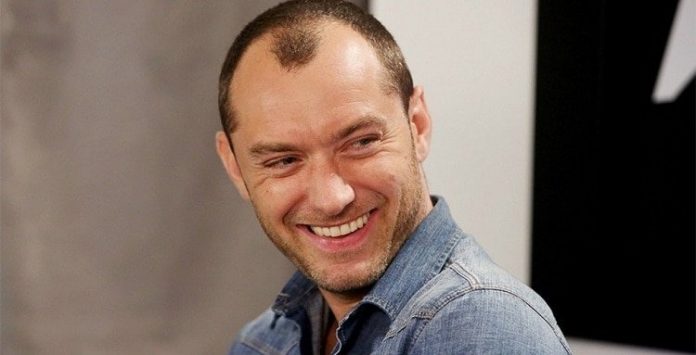 male hairline types male hairline types