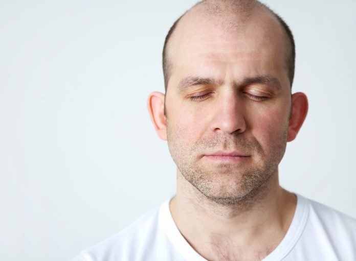 Men Going Bald Men Going Bald