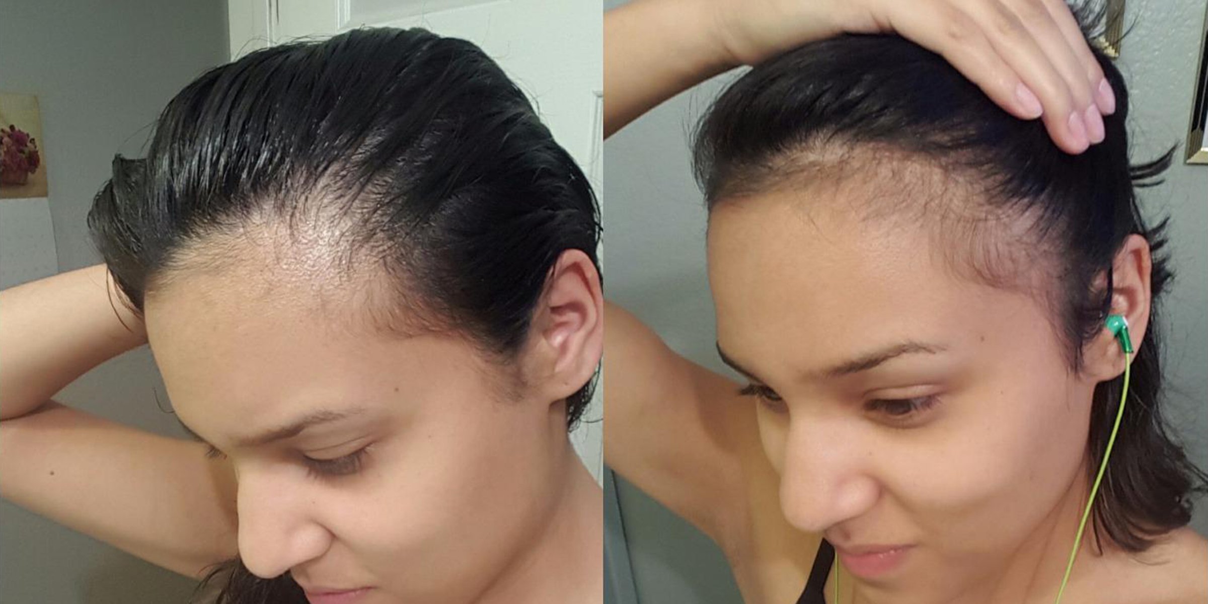 PURA D'OR Anti-Thinning Shampoo Review