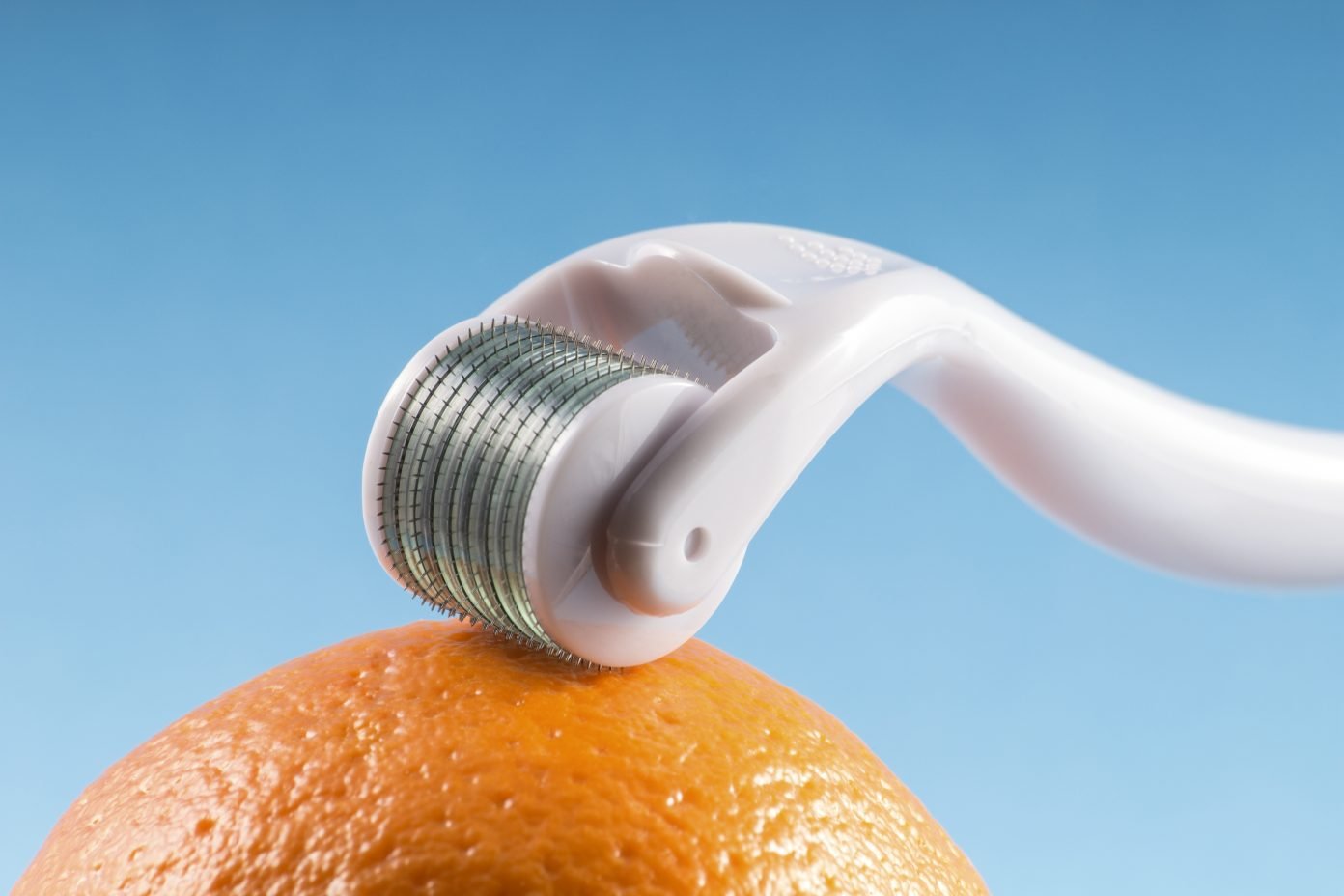 Microneedling for Hair Growth Does it Work? 2022 Hair Loss Geeks