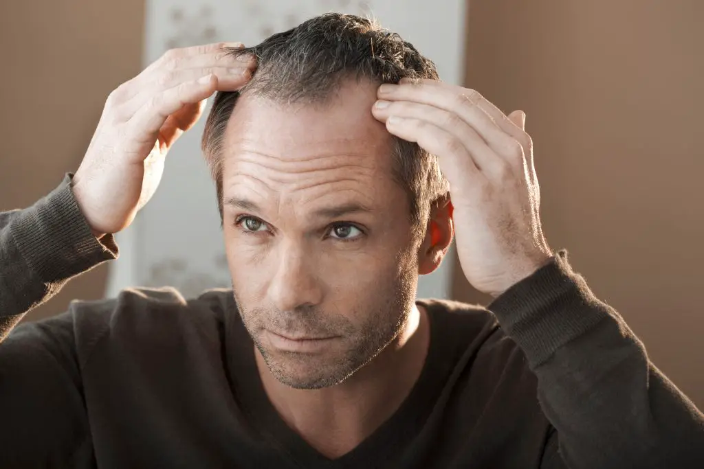 hair loss symptoms