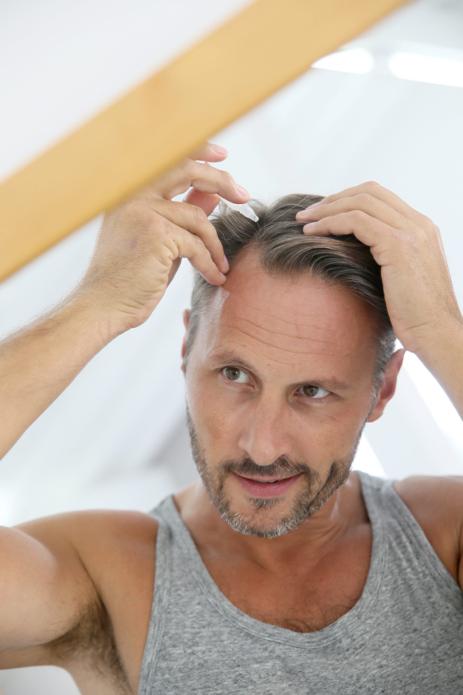 Balding Versus Mature Hairline: What's the Difference? 2022 - Hair Loss ...