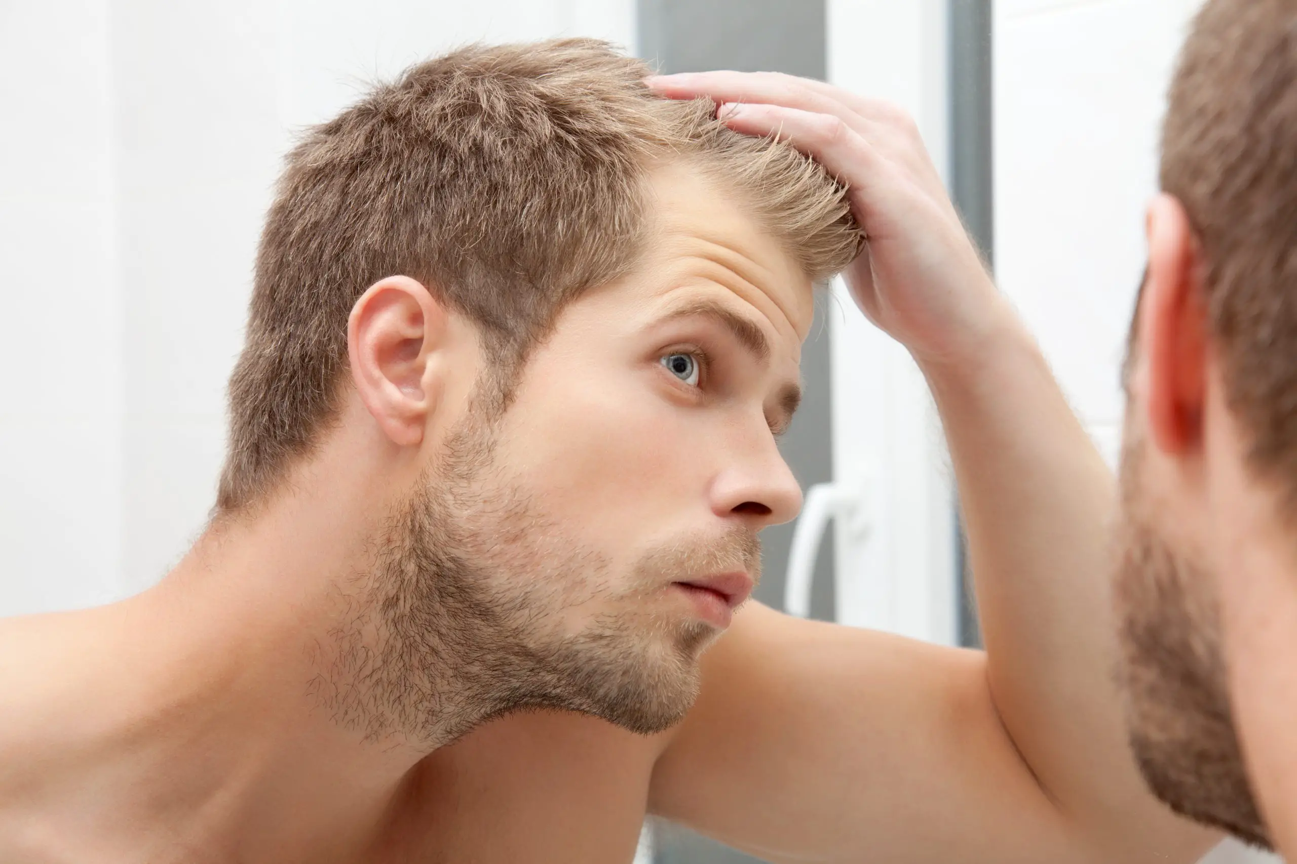 early signs of balding