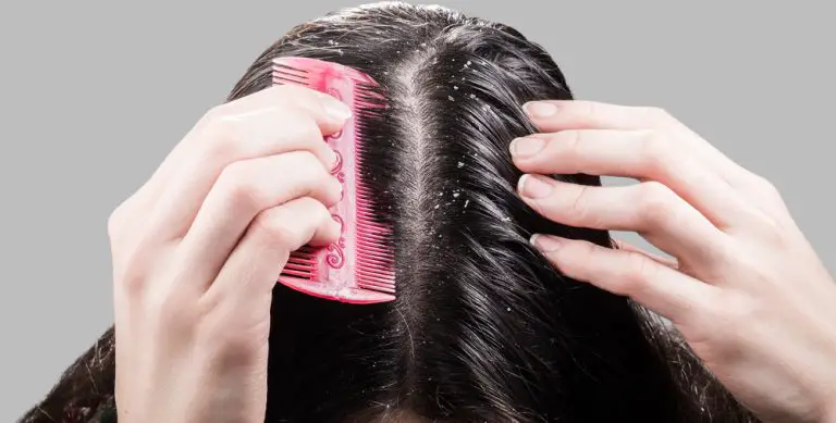 Oily Scalps: Do They Cause Hair Loss?
