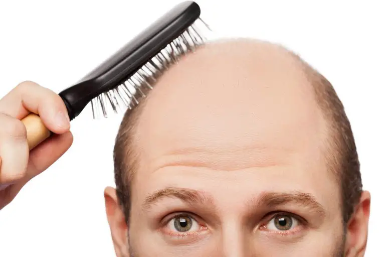 Ketoconazole for Hair Loss: Truth or Myth