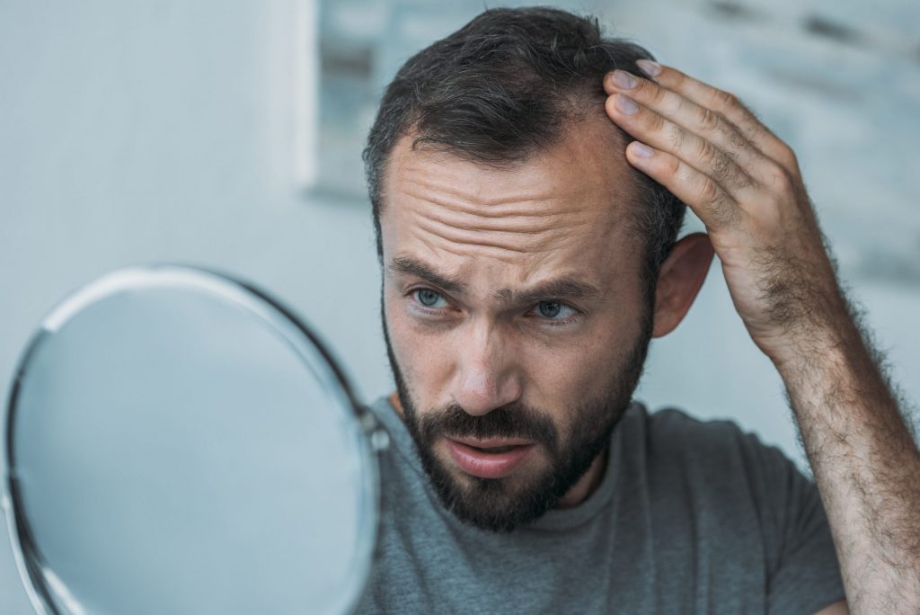 10 Common Myths About Hair Loss 2022 Hair Loss Geeks