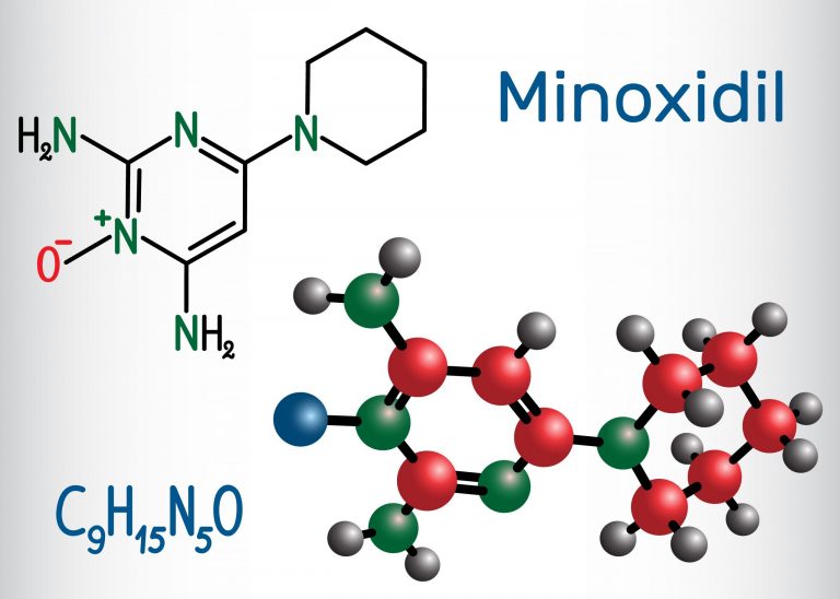 Frontal Baldness: Does Minoxidil (Rogaine) Work?