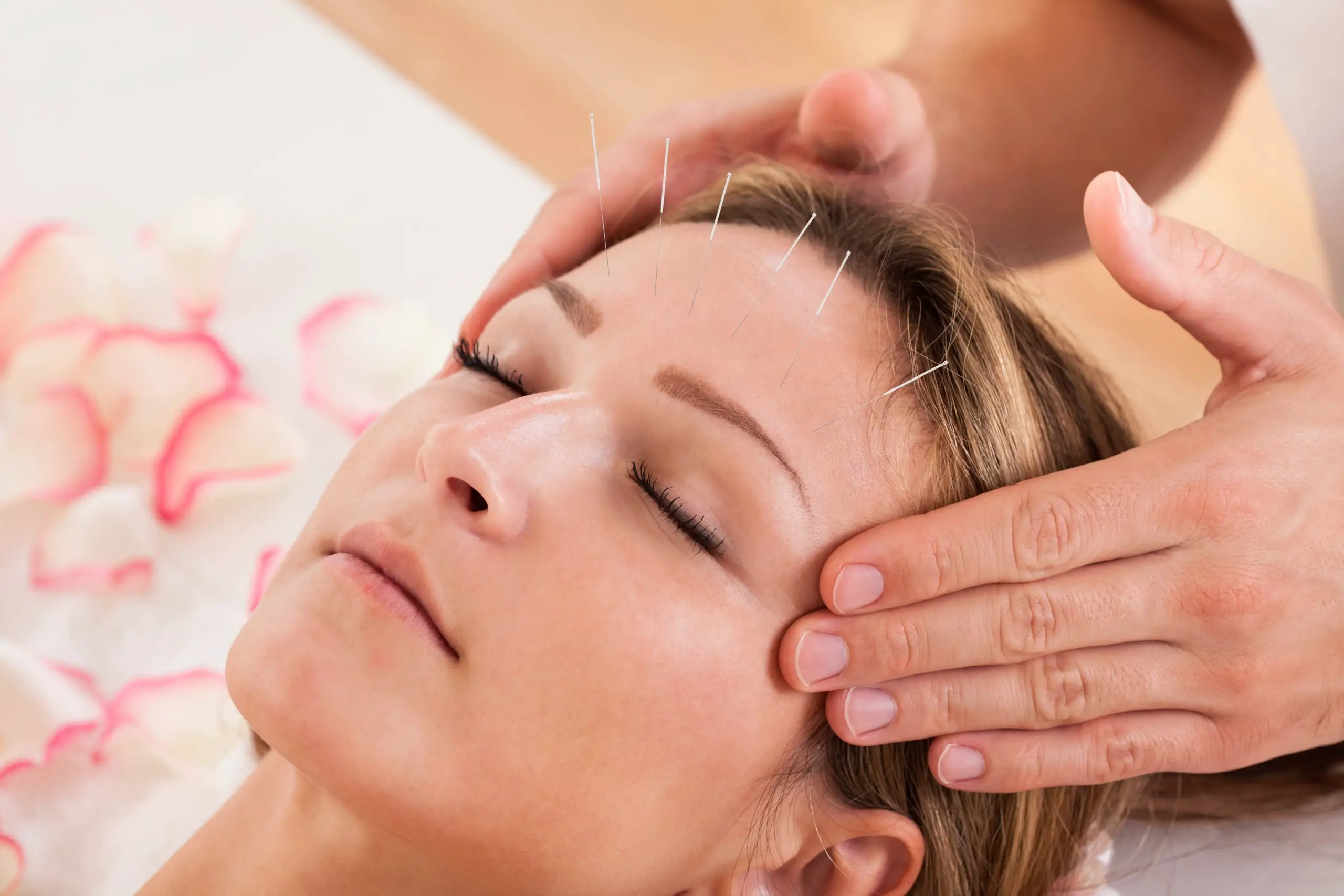 Acupuncture for Hair Growth: Benefits and Results