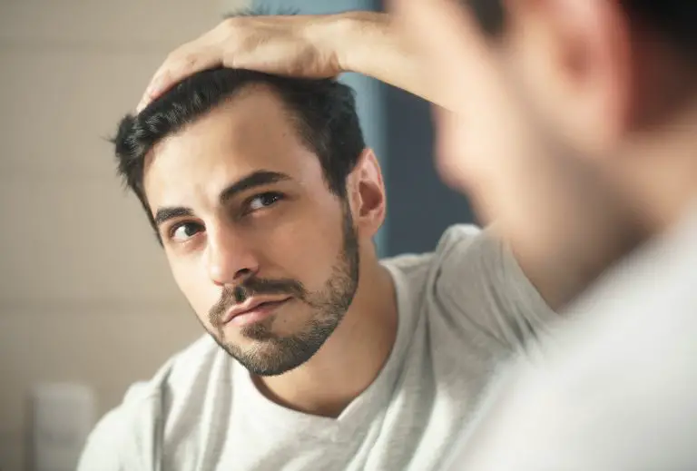 How To Deal With A Receding Hairline