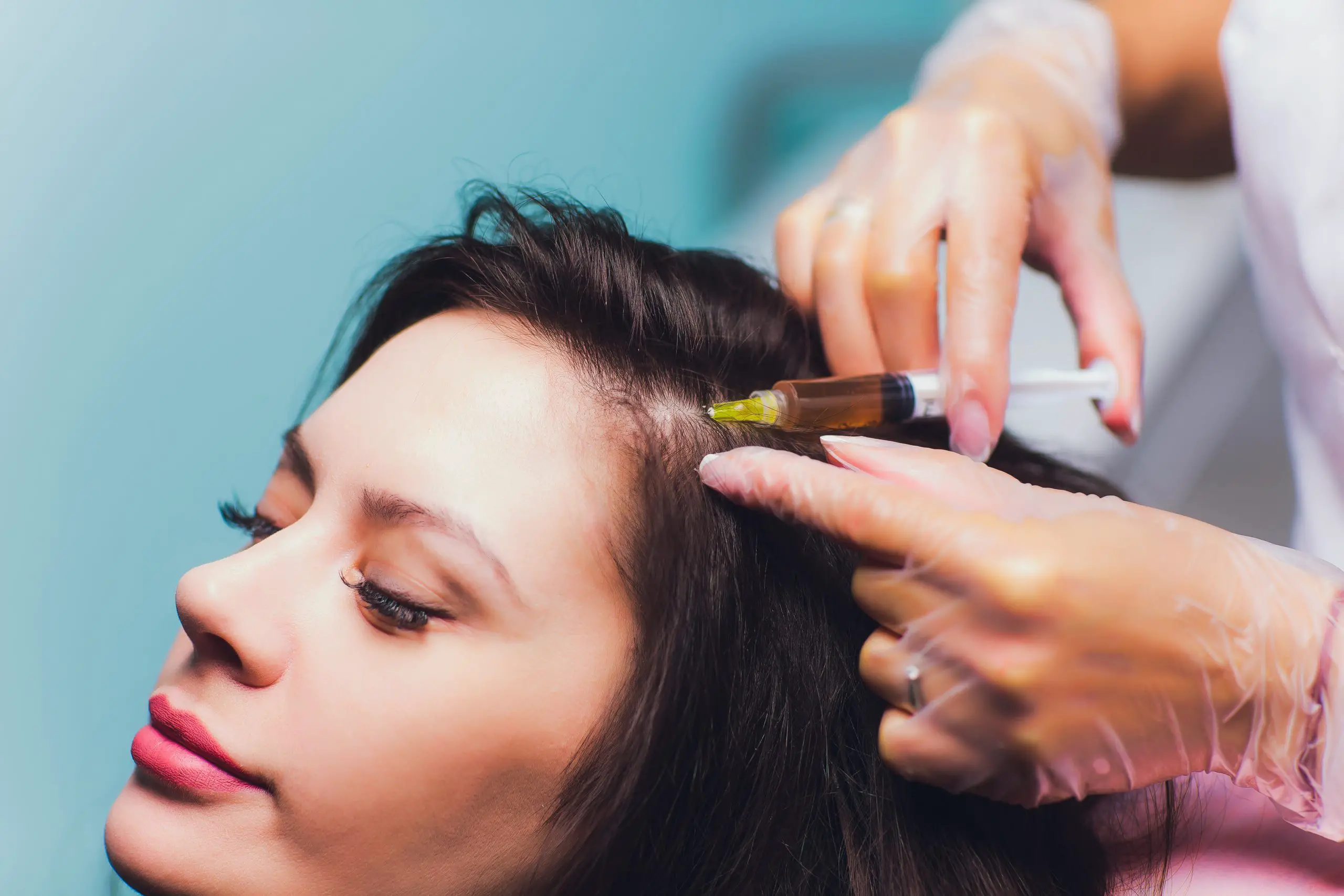 PRP for Hair Loss: All You Need to Know