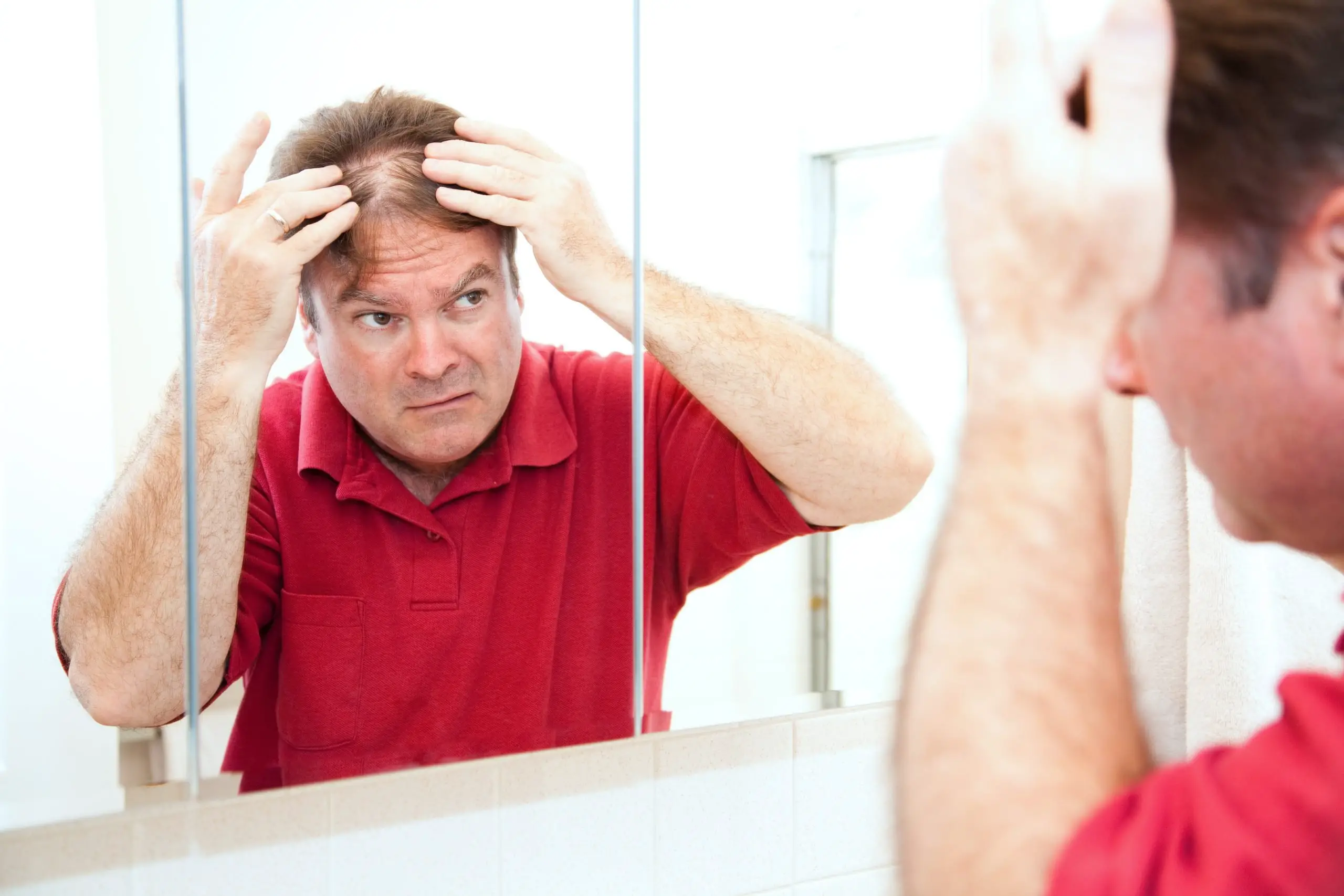 10 Common Myths About Hair Loss