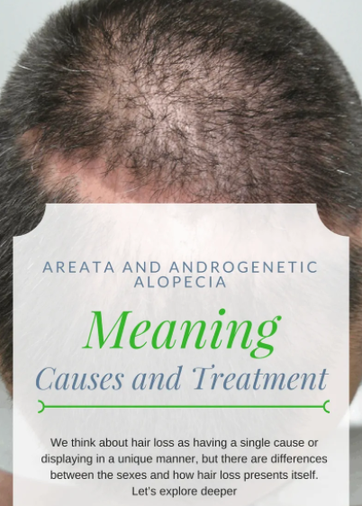 Alopecia areata diagnosis and treatment