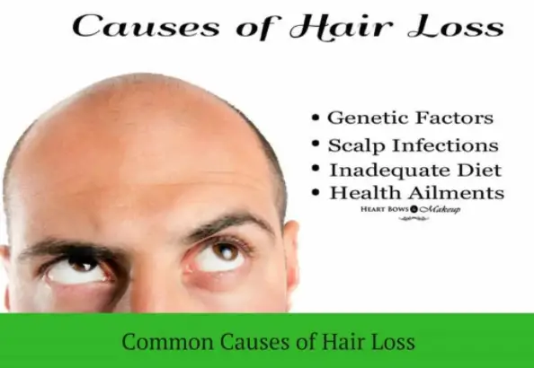 Causes of Hair Loss