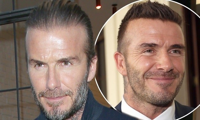 David-Beckham hair transplant