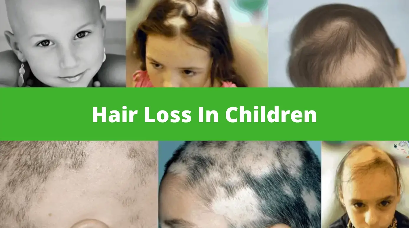 Hair Loss In Children