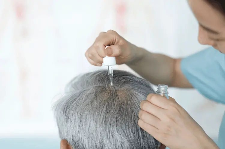 almond oil for dandruff