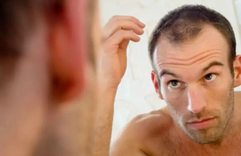 causes of hair loss in teenage males