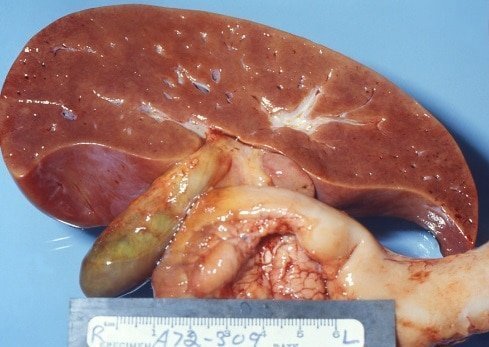 liver