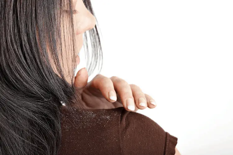 neem oil for dandruff