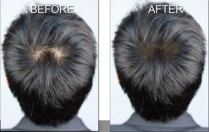 scalp makeup before and after