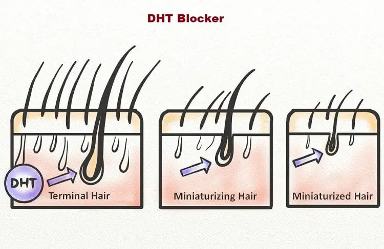 what is dht blocker?