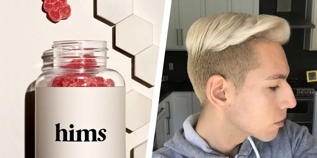 Hims vs Keeps: Which is Better for Hair Loss?