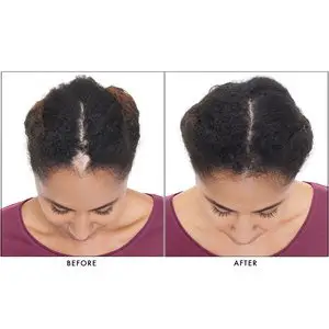 Keranique Hair Growth Reviews: Does it Work?