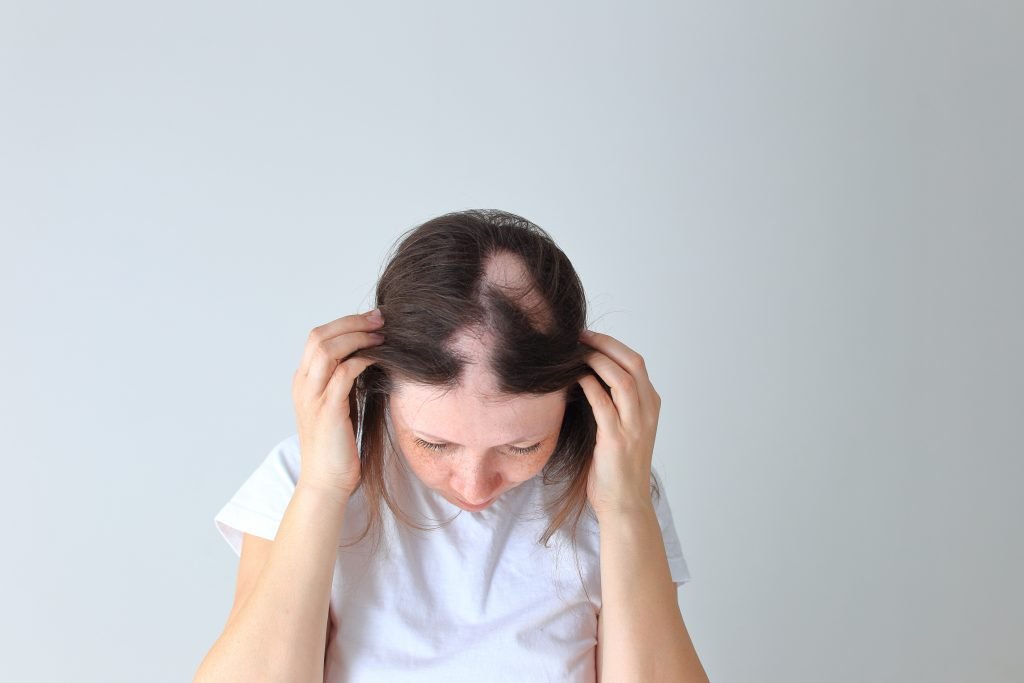 Hair Powder for Bald Spots: Good or Bad Idea?