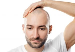 Scalp Micropigmentation: Is it Worth Doing?