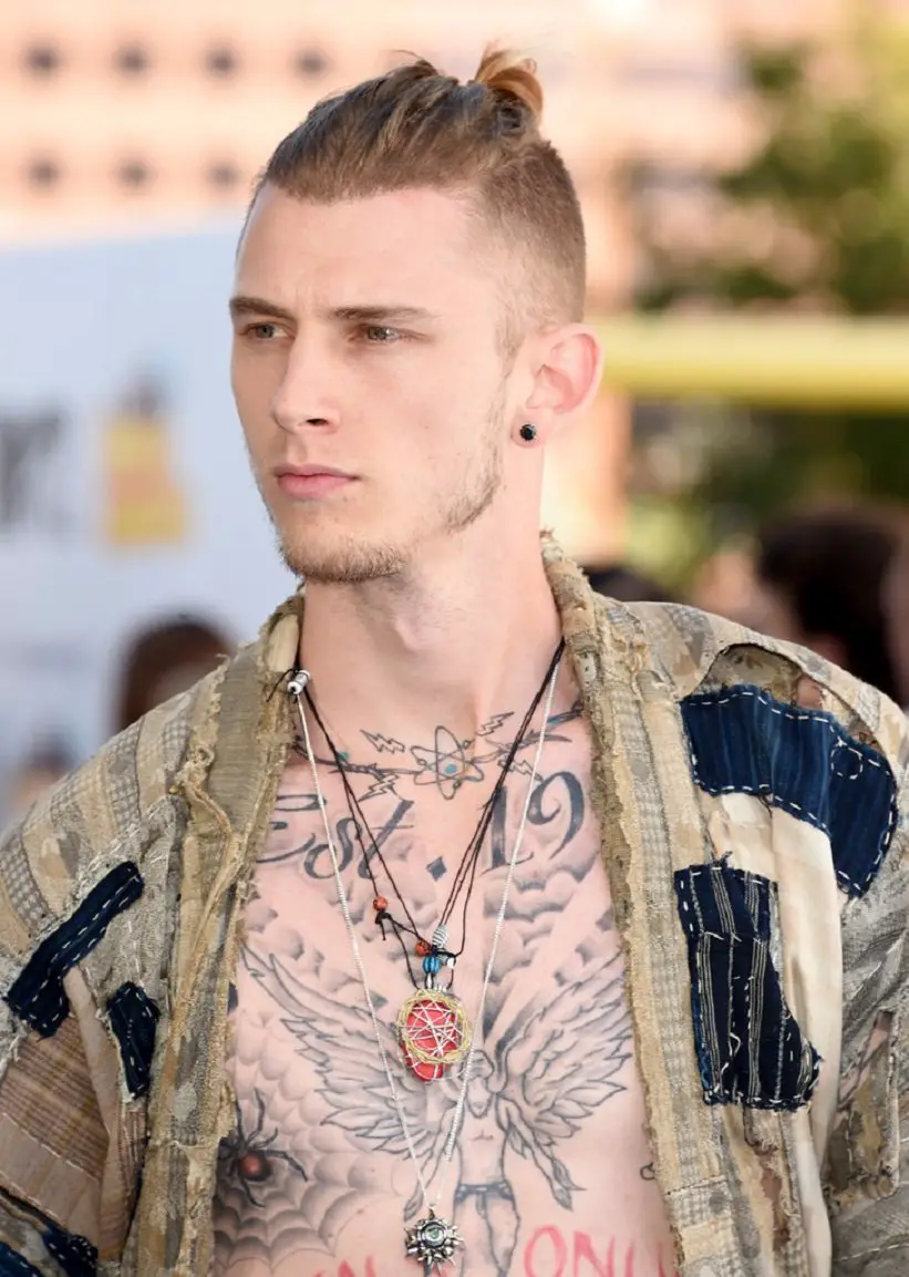 MGK Hair Transplant – Before & After