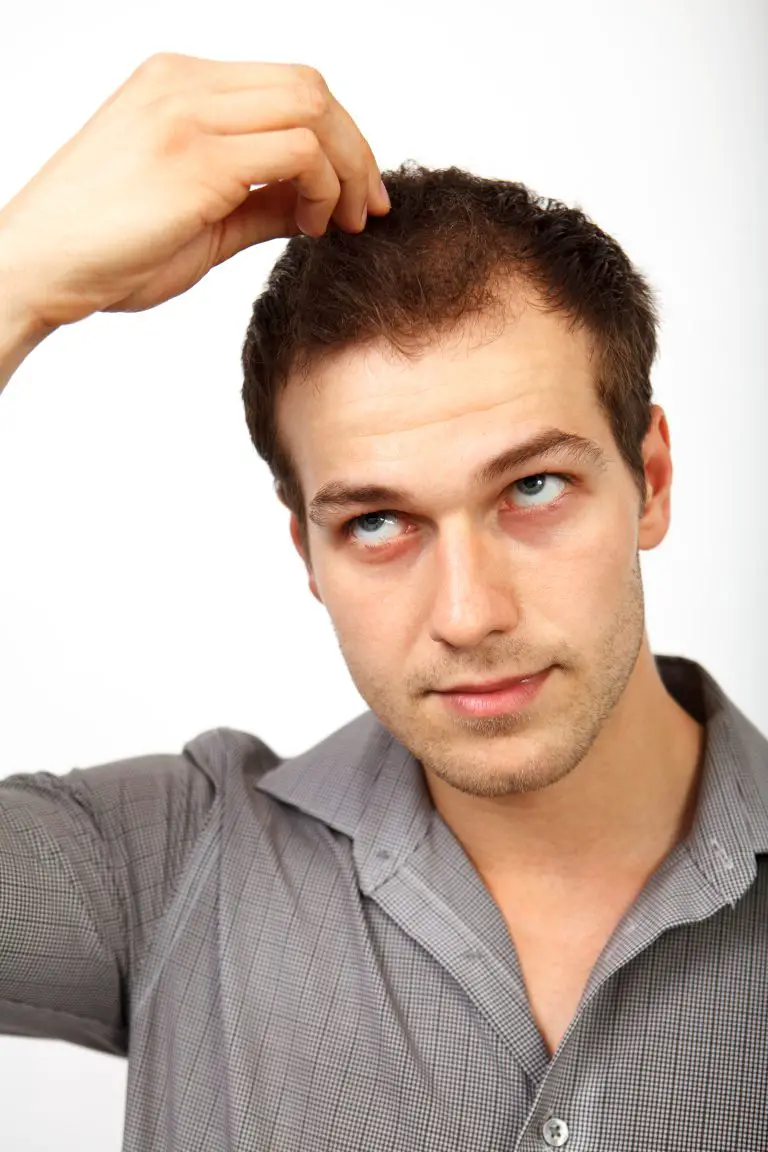 Can High Blood Pressure Cause Hair Loss?