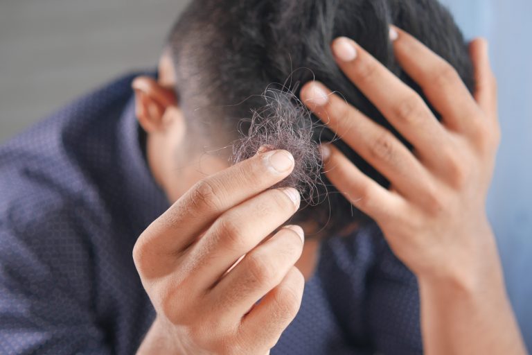 Dutasteride For Hair Loss