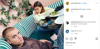 Justin Bieber Hair Loss justin bieber hair loss