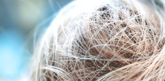 Diffuse Hair Loss: Causes And Treatments diffuse hair loss