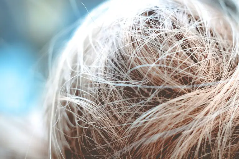 Diffuse Hair Loss: Causes And Treatments